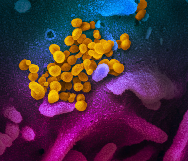 Resource Guide COVID-19 Coronavirus in Calgary microscopic view of virus